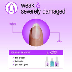 NailTek Nail Rescue System for thin, weak nails, showing a transformation to stronger, healthier nails.