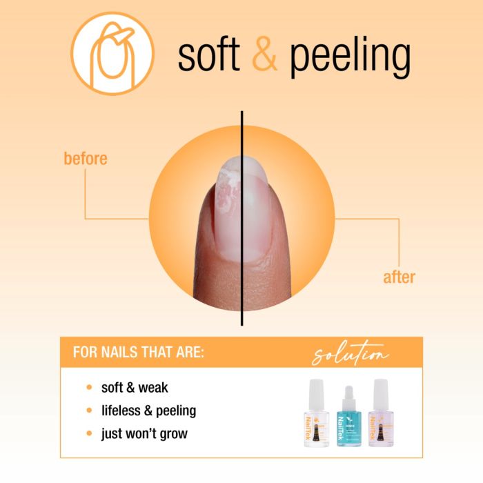 NailTek Nail Recovery System for soft, peeling nails with a visual transformation to strong, healthy nails.