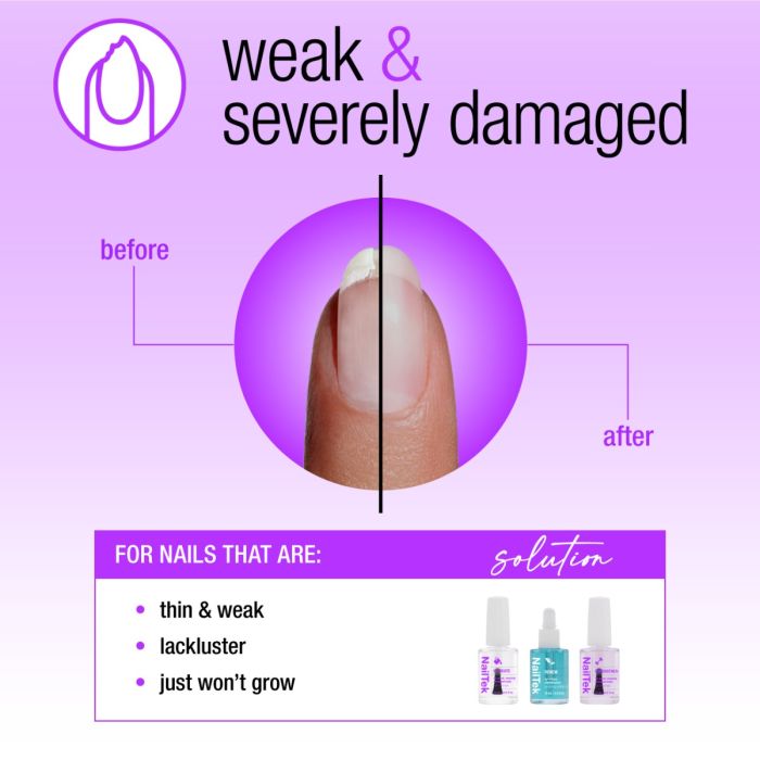 NailTek Nail Rescue System for thin, weak nails, showing a transformation to stronger, healthier nails.